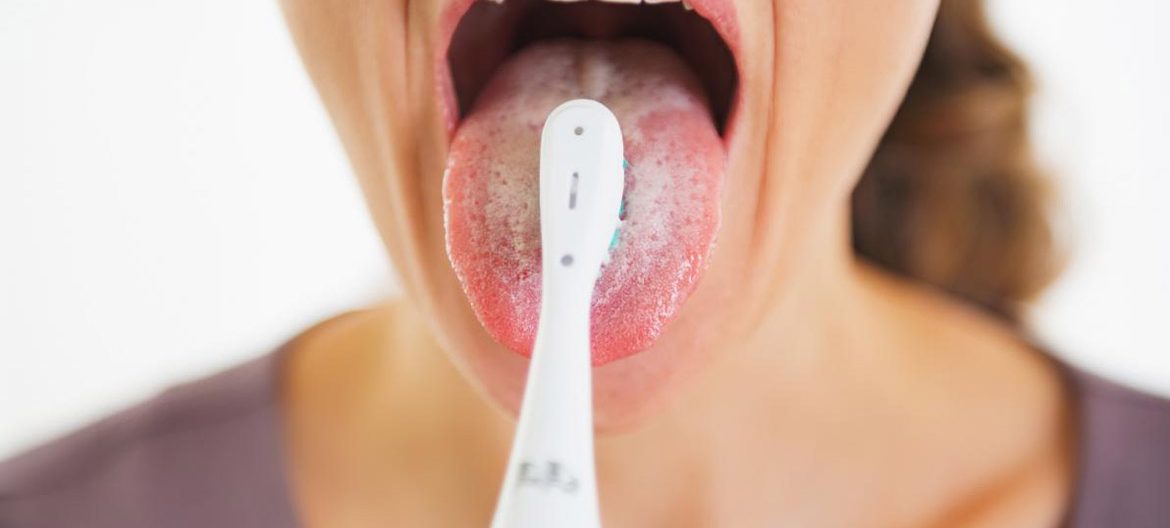 О чем говорит белый налет на языке